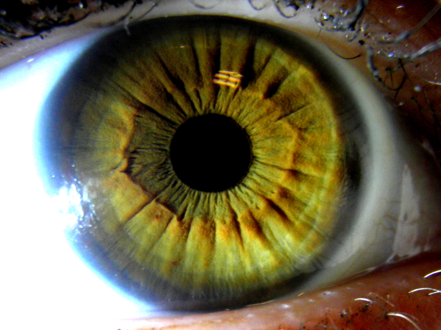 Iridologie oko psychosomatika diagnostika z očí